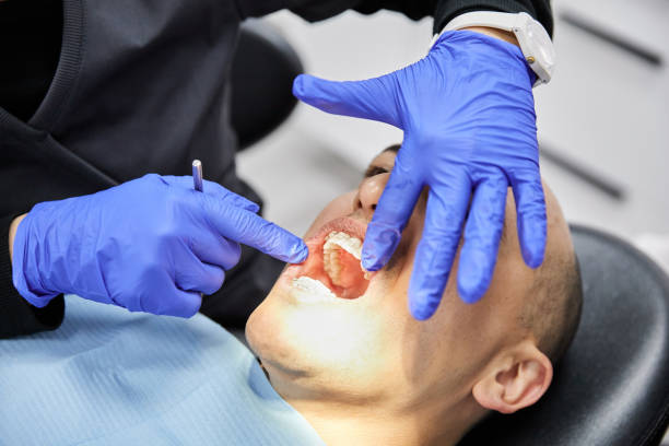 Best Emergency Dental Care for Broken or Chipped Teeth in Baltimore, OH