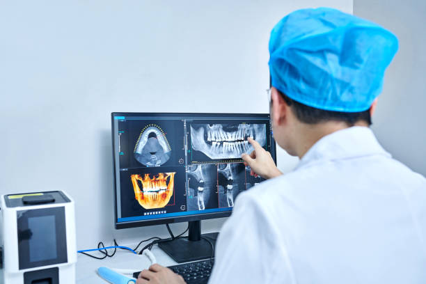 Best Emergency Wisdom Teeth Removal in Baltimore, OH