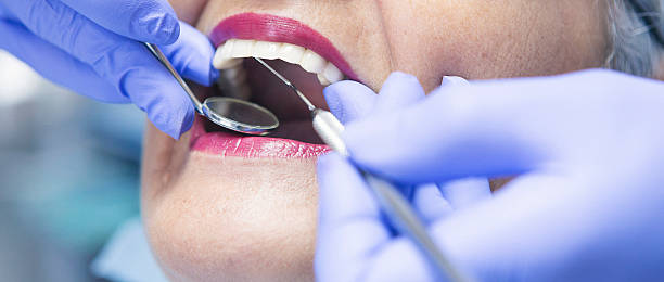 Best Emergency Root Canal Treatment in Baltimore, OH